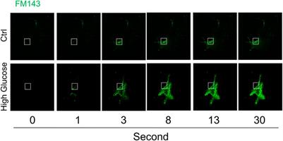 Impairment of Ceramide-Mediated Endothelial Instant Membrane Resealing During Diabetes Mellitus